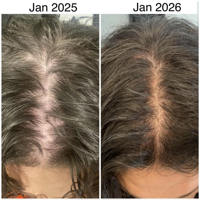 Hair Growth Scalp Massager + FREE Hair Oil !