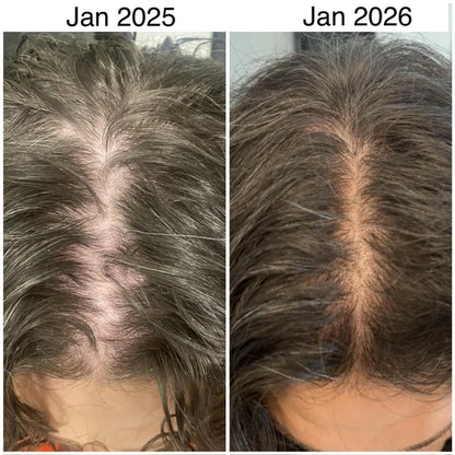 Hair Growth Scalp Massager + FREE Hair Oil !